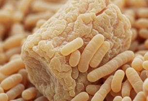 Does kefir have Saccharomyces?